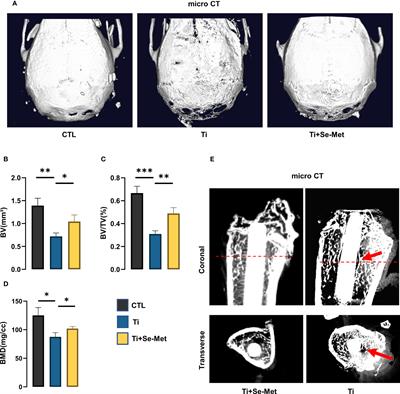 Selenomethionine against titanium particle-induced osteolysis by regulating the ROS-dependent NLRP3 inflammasome activation via the β-catenin signaling pathway